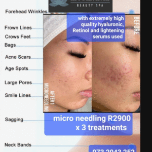 Micro Needling Treatments